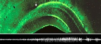 New article in “Cerebral Cortex”: Epileptic state stimulates genesis of nerve cells - Neurogenesis suspected in turn to promote epileptic activity