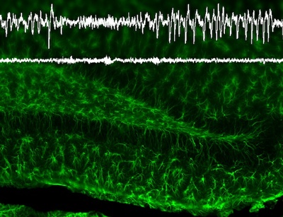 More than just glue: Neuroscientists from Freiburg show that glial cells protect the brain from epileptic seizures