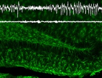 More than just glue: Neuroscientists from Freiburg show that glial cells protect the brain from epileptic seizures