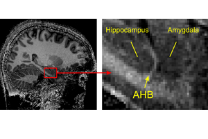 A Sharper View into the Brain: Researchers from Freiburg are the first to detect the exact border between two important brain regions