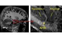 A Sharper View into the Brain: Researchers from Freiburg are the first to detect the exact border between two important brain regions