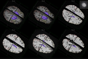 "Should I stay or should I go?" –  A newly discovered type of neuron could be the key to understanding why we initiate or inhibit movement