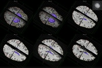 "Should I stay or should I go?" –  A newly discovered type of neuron could be the key to understanding why we initiate or inhibit movement