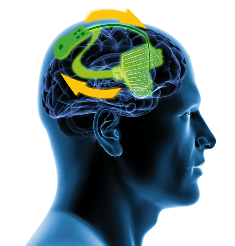 Closed-loop stimulation promises fewer side effects: How adaptive stimulation could make a significant difference for patients with neurological disorders such as Parkinson’s disease